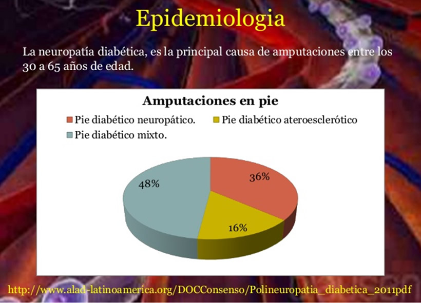 Polineuropatía y Neuropatía