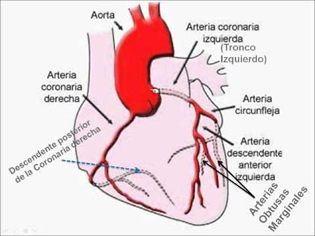 Lesiones vasculares